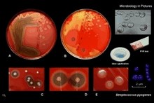 streptococcus pyogenes